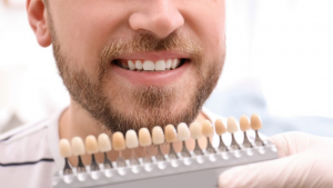 Professional teeth whitening