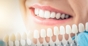 Teeth Whitening: Things to Know About Getting a Brighter Smile