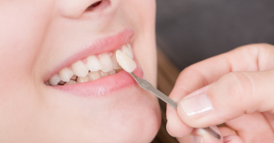 What is a dental crown