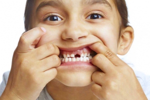Why do children need braces?
